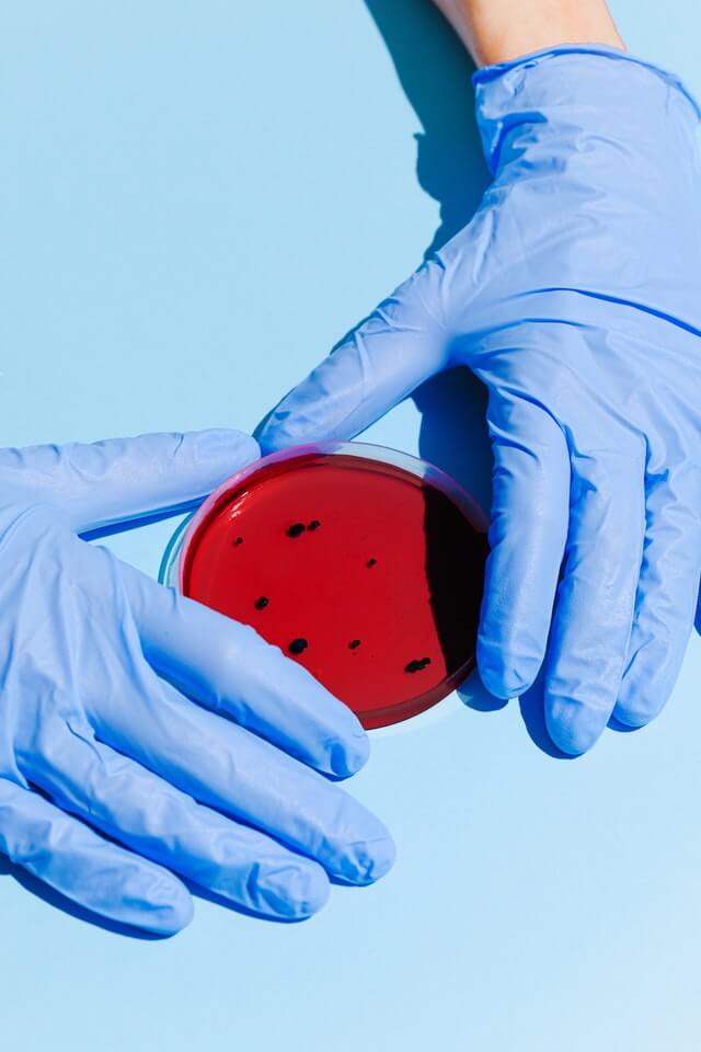 About Us diagnostic lab sampling